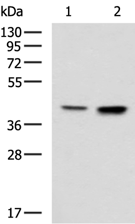 Rabbit Polyclonal Antibody to CSNK2A2