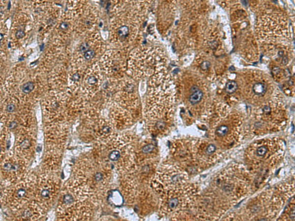 Rabbit Polyclonal Antibody to CLASP2