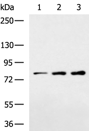 Rabbit Polyclonal Antibody to CLCN7