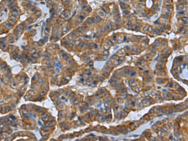 Rabbit Polyclonal Antibody to CLIC2