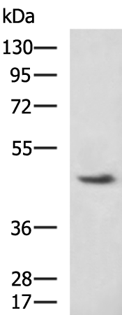 Rabbit Polyclonal Antibody to CLIC5