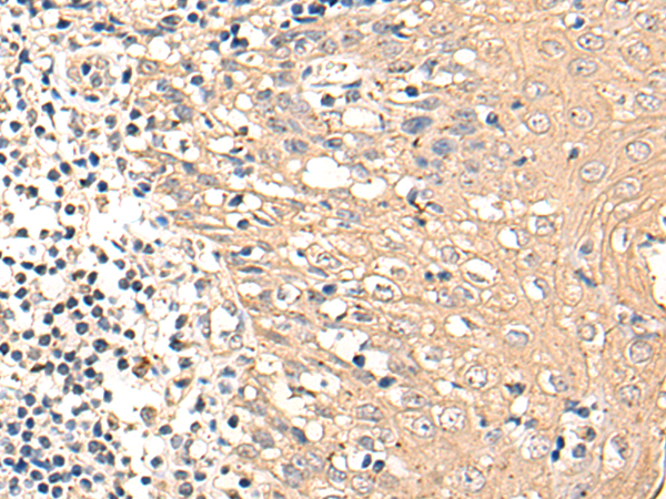 Rabbit Polyclonal Antibody to CLINT1