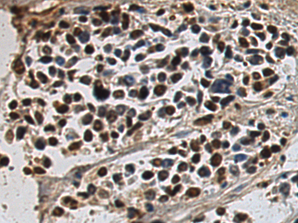 Rabbit Polyclonal Antibody to CLK4