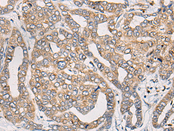 Rabbit Polyclonal Antibody to CLPTM1