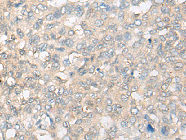 Rabbit Polyclonal Antibody to CLUL1