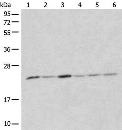 Rabbit Polyclonal Antibody to CMPK1