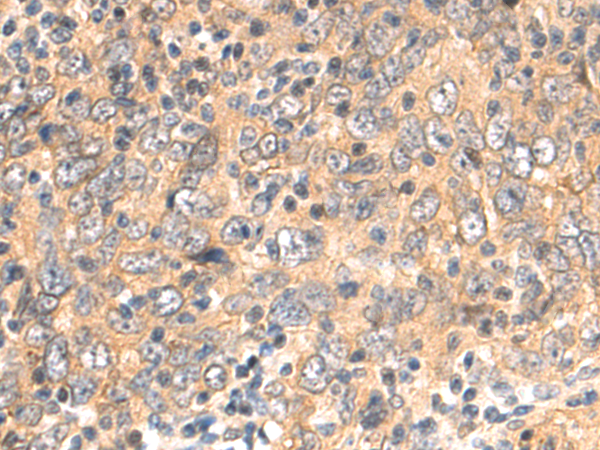 Rabbit Polyclonal Antibody to CNBP