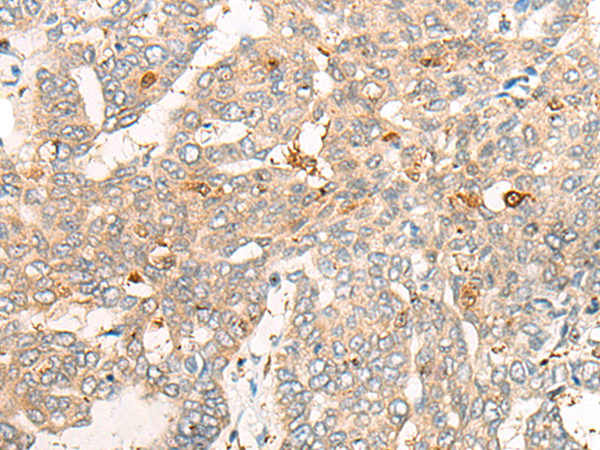 Rabbit Polyclonal Antibody to CNDP2