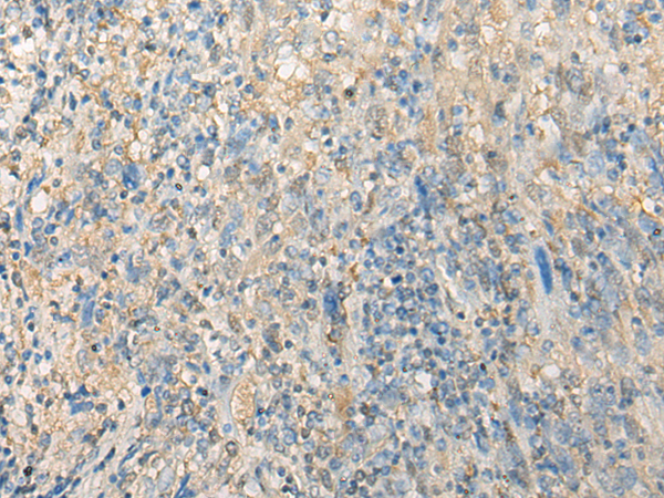 Rabbit Polyclonal Antibody to CNN2