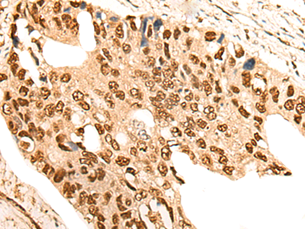 Rabbit Polyclonal Antibody to CNOT10
