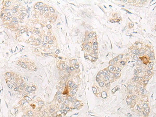 Rabbit Polyclonal Antibody to CNOT2