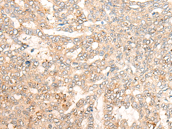 Rabbit Polyclonal Antibody to CNTN4
