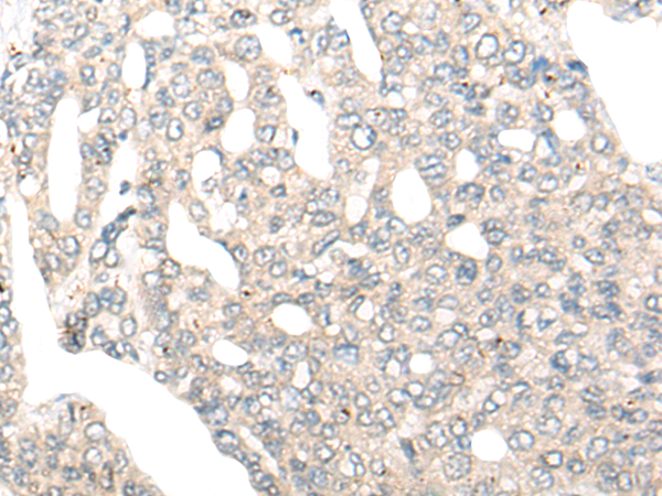 Rabbit Polyclonal Antibody to COG4