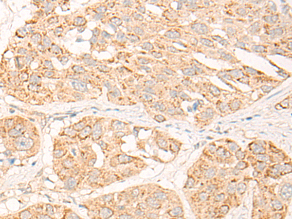 Rabbit Polyclonal Antibody to COG2