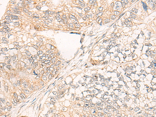 Rabbit Polyclonal Antibody to COG5