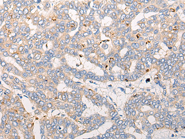 Rabbit Polyclonal Antibody to COL11A1