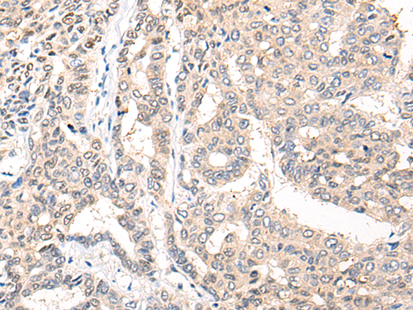 Rabbit Polyclonal Antibody to COL9A1