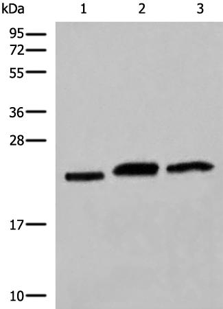 Rabbit Polyclonal Antibody to COPS8