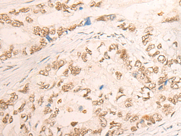 Rabbit Polyclonal Antibody to COPS6