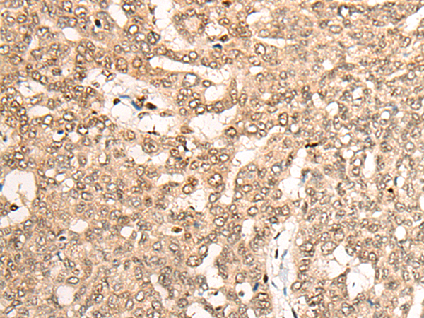 Rabbit Polyclonal Antibody to COPS7A