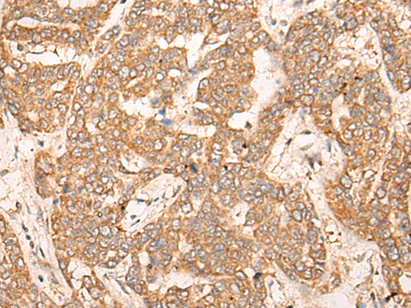 Rabbit Polyclonal Antibody to COPZ1