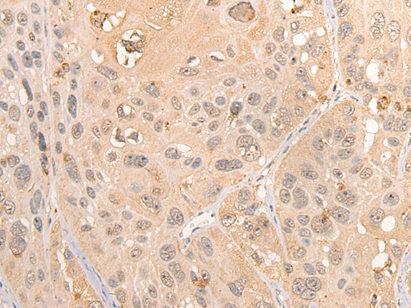 Rabbit Polyclonal Antibody to RCOR3