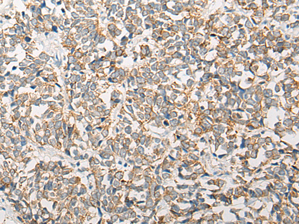Rabbit Polyclonal Antibody to CORO2A