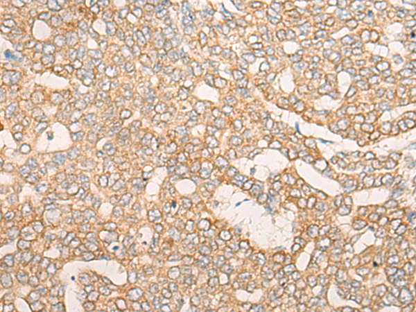 Rabbit Polyclonal Antibody to CORO7