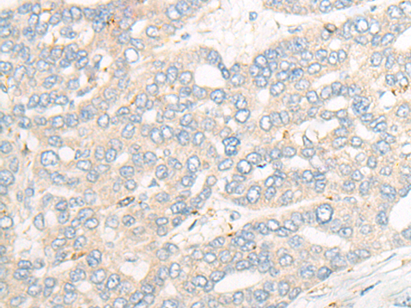 Rabbit Polyclonal Antibody to CORO1A
