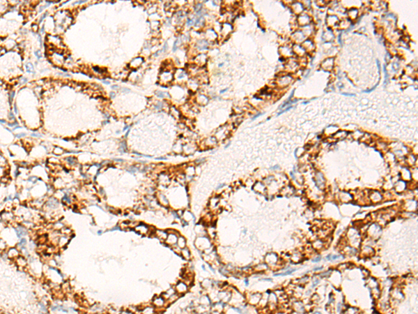 Rabbit Polyclonal Antibody to ABCC6