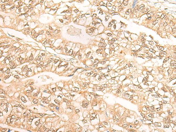 Rabbit Polyclonal Antibody to DMC1