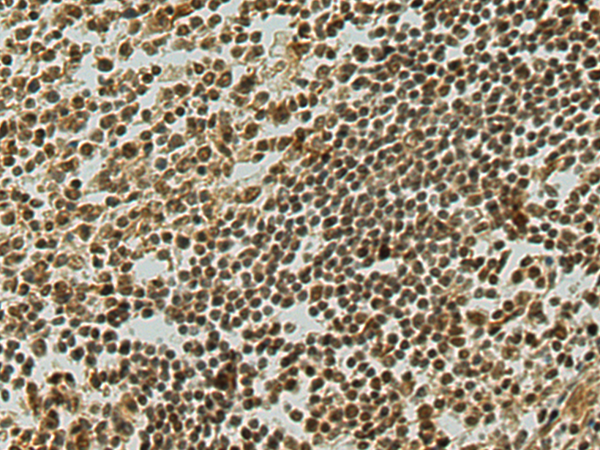 Rabbit Polyclonal Antibody to MIER1