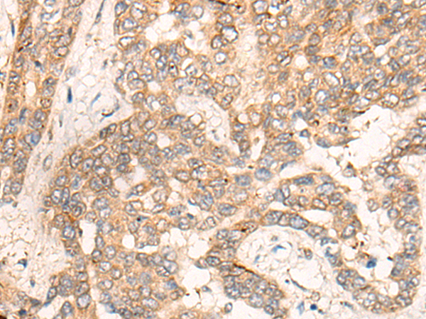 Rabbit Polyclonal Antibody to CPEB4