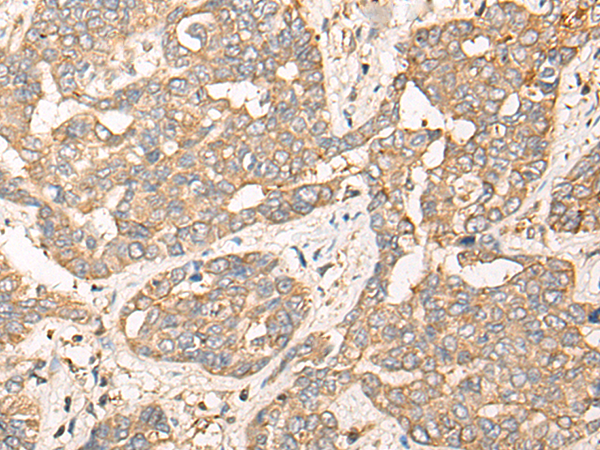 Rabbit Polyclonal Antibody to CPNE3