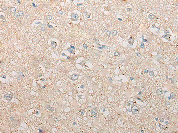 Rabbit Polyclonal Antibody to CPNE4