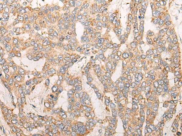 Rabbit Polyclonal Antibody to CPNE6