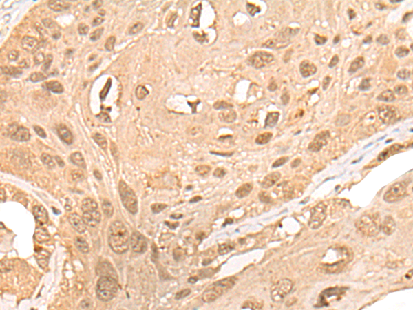 Rabbit Polyclonal Antibody to CPNE7