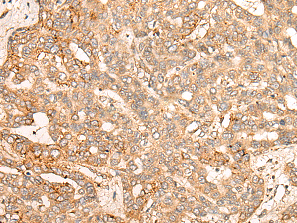 Rabbit Polyclonal Antibody to CPNE8
