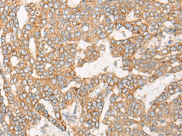 Rabbit Polyclonal Antibody to CPT1B