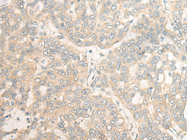 Rabbit Polyclonal Antibody to CPVL