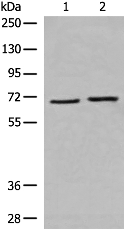 Rabbit Polyclonal Antibody to CRAT
