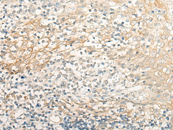 Rabbit Polyclonal Antibody to CRB3