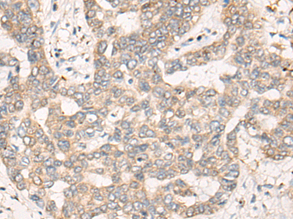 Rabbit Polyclonal Antibody to CREB3L2