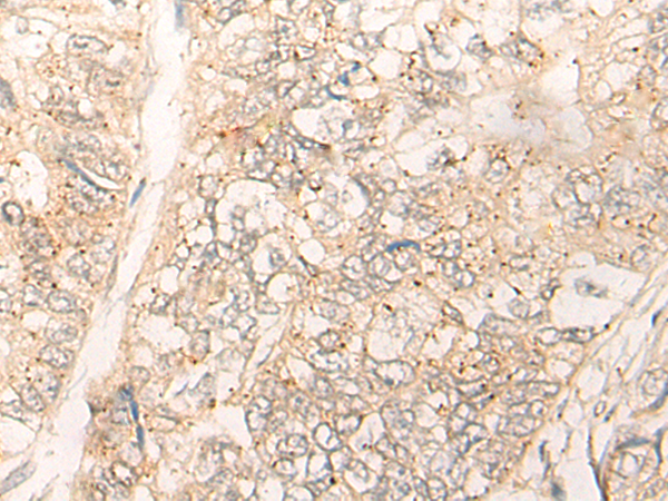 Rabbit Polyclonal Antibody to CUTA