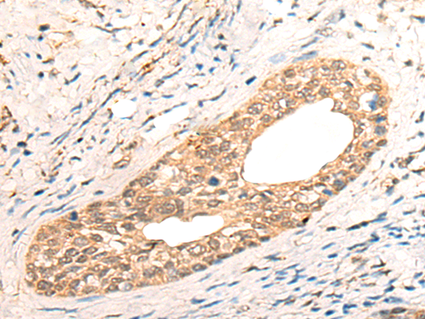Rabbit Polyclonal Antibody to CWF19L1