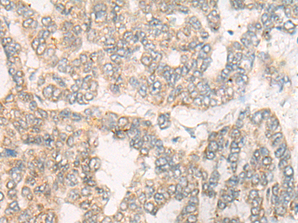 Rabbit Polyclonal Antibody to CYFIP1