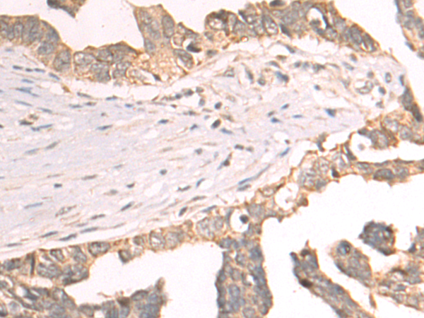Rabbit Polyclonal Antibody to CYP20A1