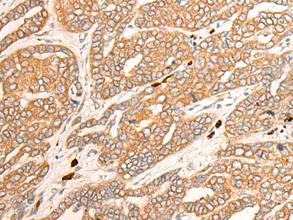 Rabbit Polyclonal Antibody to CYP3A43