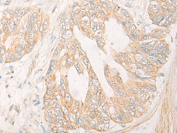 Rabbit Polyclonal Antibody to CYP4F12