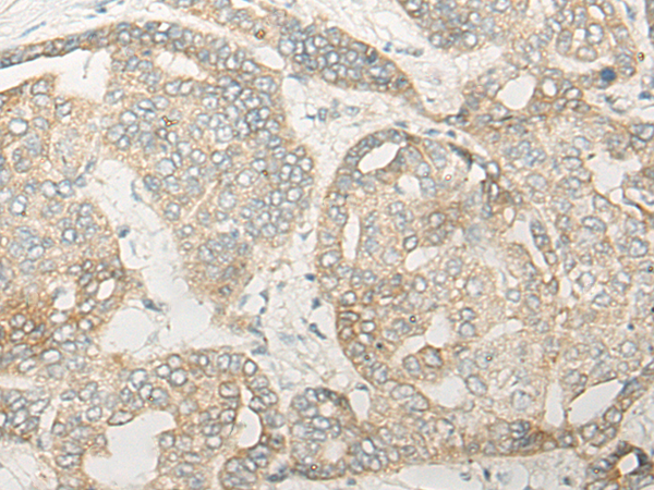 Rabbit Polyclonal Antibody to CYP4X1